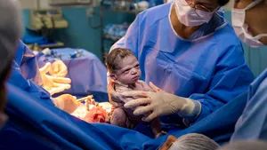 Un bebeluş brazilian a uimit cu gestul pe care l-a făcut imediat după ce s-a născut