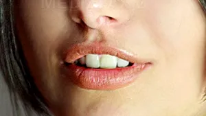 Cum poate periuţa de dinţi să-ţi distrugă zâmbetul?