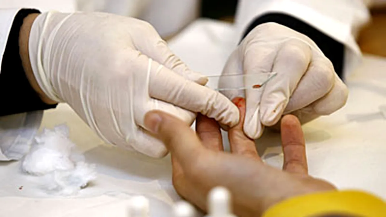 O nouă variaţie genetică a virusului HIV, identificată de cercetătorii francezi