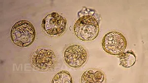 Minunea secolului XXI pe cale să se întâmple? Un animal preistoric, dispărut acum mii de ani, ar putea fi readus la viaţă