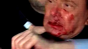 Berlusconi, plin de sânge după ce a fost lovit de un bărbat - VIDEO