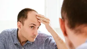 Turismul medical, schimbat de pandemie. Românii nu mai merg în Turcia pentru transplant de păr, apelează la clinicile din ţară