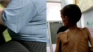 Unu din doi oameni de pe planetă manâncă prea mult sau prea puţin. Studiu: Decesele cauzate de alimentaţia nesănătoasă au crescut cu 15% în ultimul deceniu