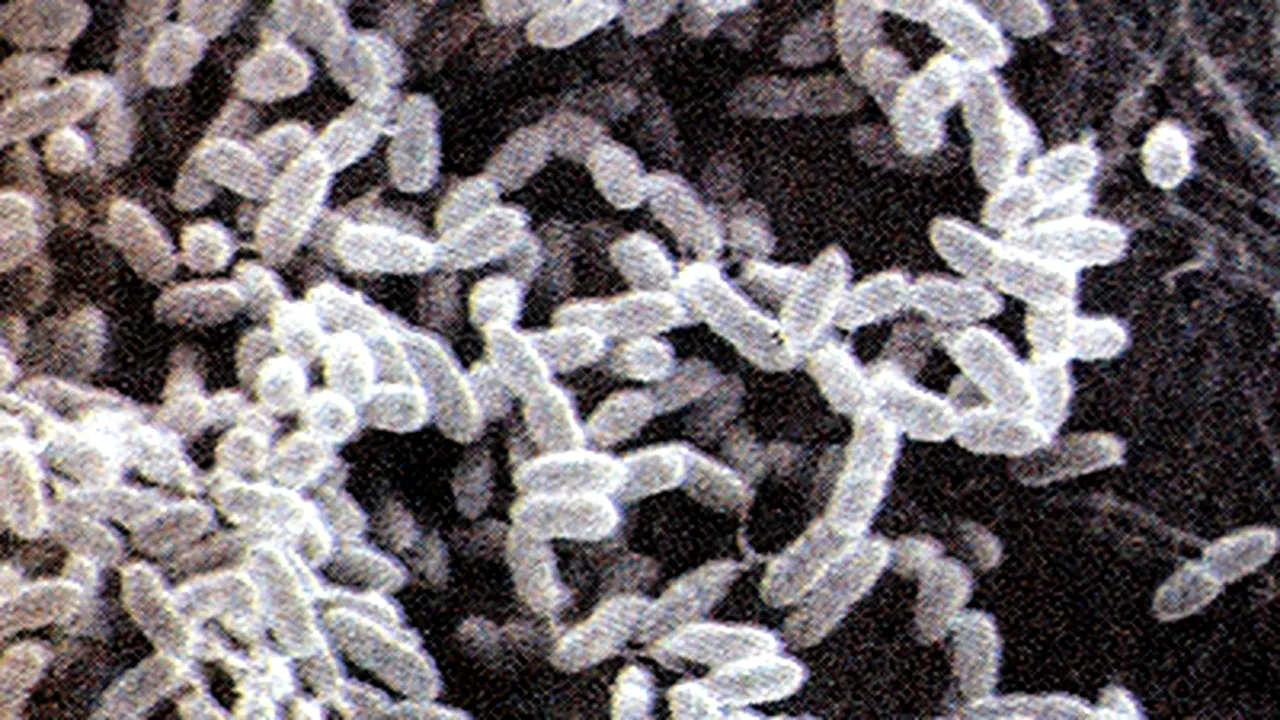 Cancerul la colon, cauzat de o bacterie care provoacă diareea