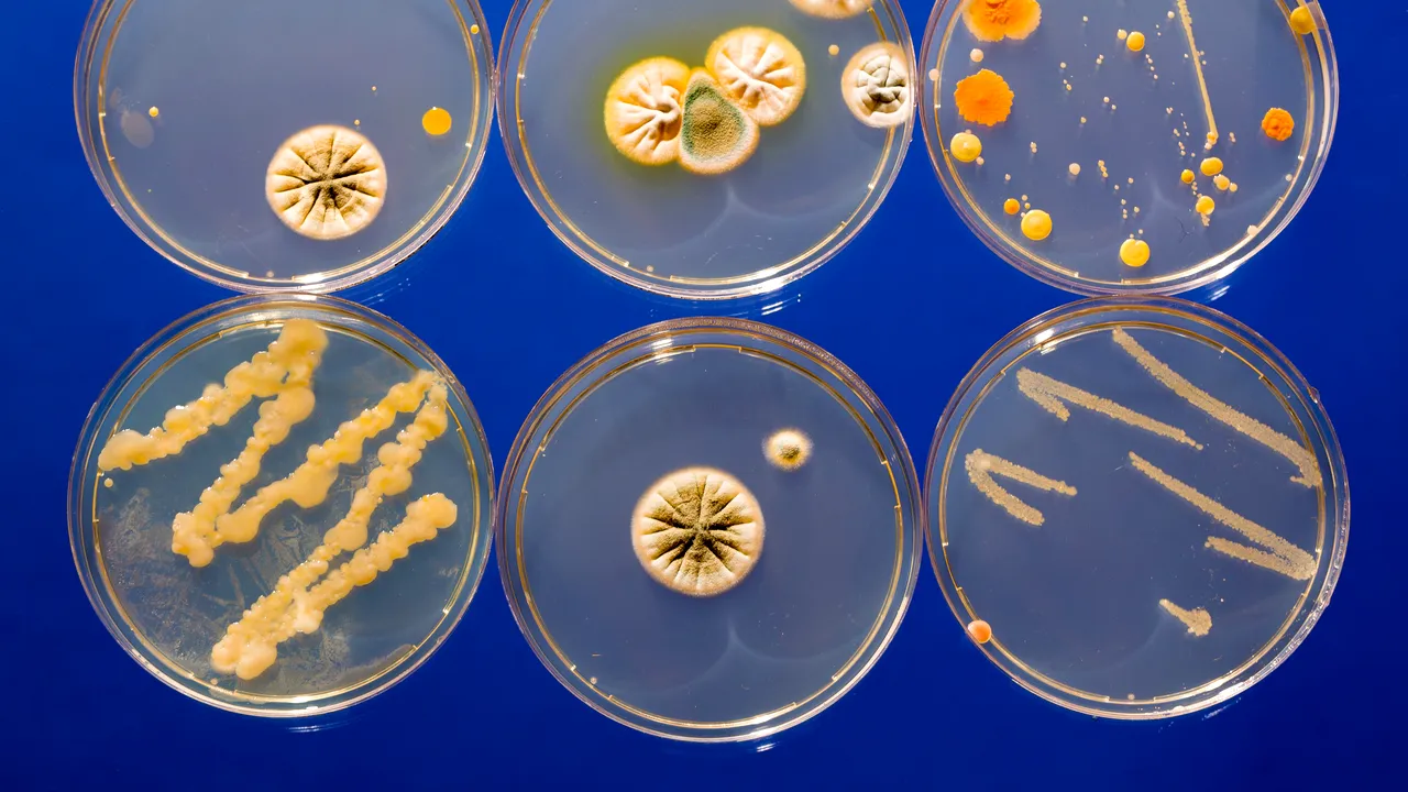 Concluziile anchetei epidemiologice: E.Coli în probele de alimente şi apă de la domiciliu, în cazul morţii fetiţei de 3 ani din Iaşi