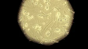 Listele de aşteptare pentru transplant ar putea deveni istorie: Japonezii au creat în premieră ţesut renal din celule suşă