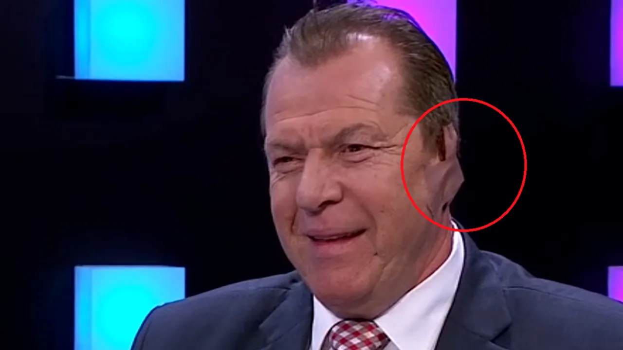 Duckadam a apărut cu urechea bandajată în direct la TV: Am spus că o tai dacă se face transferul