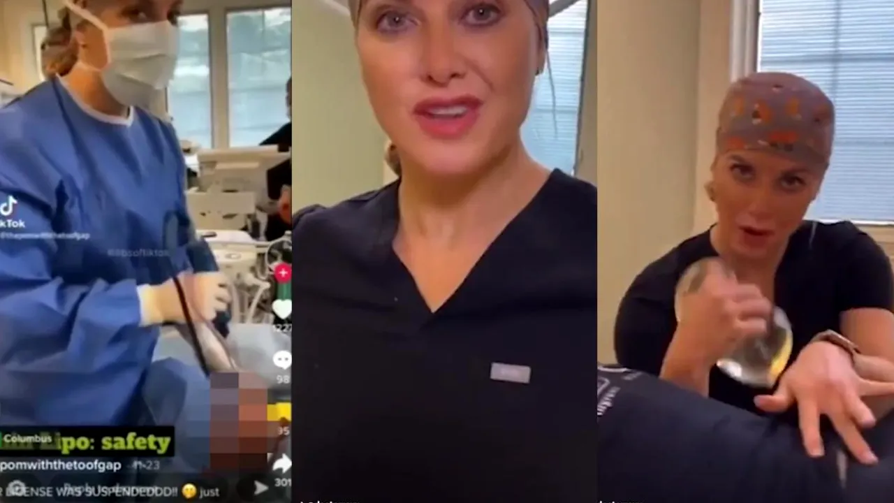 Ce a păţit un chirurg plastician care a distribuit o operaţie de liposucţie pe TikTok