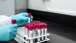 Dioxidul de carbon din atmosferă schimbă sângele oamenilor. Ce au descoperit cercetătorii