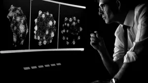 Experiment fără precedent, condus la Stanford de profesorul român Sergiu Pașca / Cum a fost creat șoarecele cu 90% creier uman