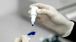 Albastru de metilen: beneficii şi utilizări