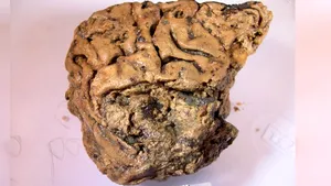 Un creier uman „a supravieţuit” 2.600 de ani într-un craniu. Explicaţia oamenilor de ştiinţă
