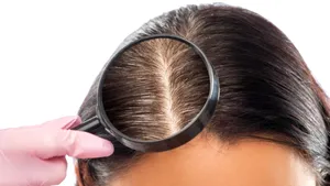 Ce definește un șampon antimătreață bun pentru păr și scalp? (P)