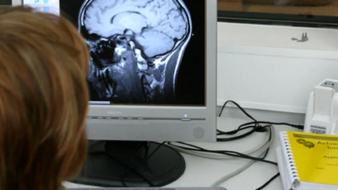 O procedură revoluţionară care deblochează circulaţia cerebrală va fi folosită la Galaţi
