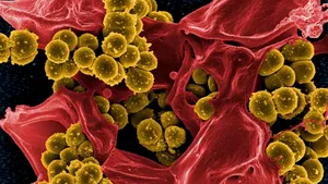 Medic infecţionist: „Stafilococul auriu se găseşte peste tot. Problema e când îl găsim în organism”/ „Majoritatea bebeluşilor dobândesc bacteria la naştere”