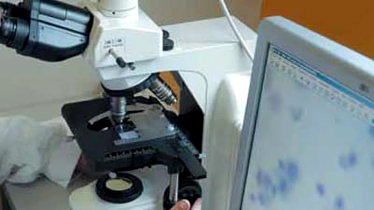Microscop ce poate detecta artroza în stadiul incipient