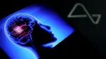 O nouă metodă de scanare cerebrală ar putea ajuta persoanele cu epilepsie rezistentă la medicamente