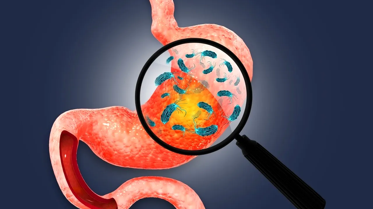 Cum să depistezi infecția cu Helicobacter pylori și ce soluții există (P)