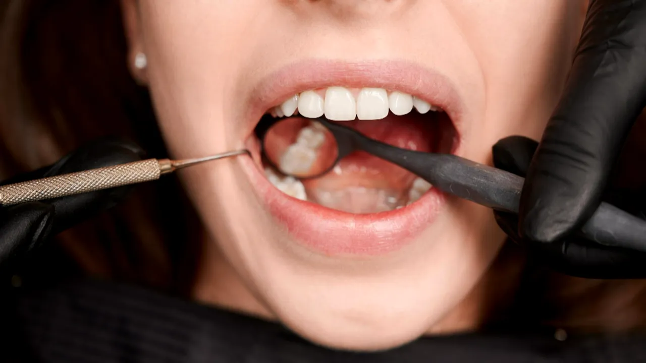 Te confrunţi cu probleme dentare? Ce variante de tratament există pentru cele mai comune afecţiuni
