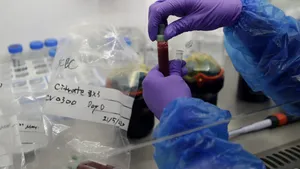 Un nou test de sânge poate detecta din timp 12 tipuri de cancer