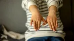 Virusolog: Rujeola poate cauza daune permanente sistemului imunitar și creierului