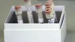 Un test simplu de sânge ar putea ajuta la depistarea timpurie a bolii Parkinson