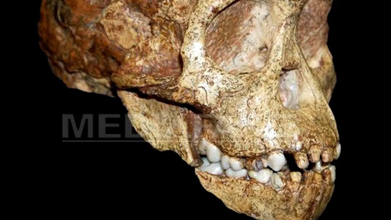 STUDIU: Craniul 
