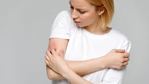 Cum identifici tipul de dermatită în funcţie de simptome