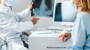 Care este cea mai performantă metodă de evaluare a sechelelor post-COVID. Tomografia computerizată versus radiografia pulmonară. Explicaţiile unui medic
