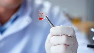 Care este cea mai periculoasă expunere la coronavirus? Doza virală este decisivă