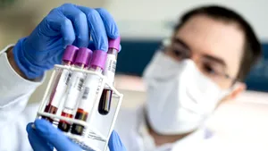 FT: Germania va efectua primele testări masive din Europa pentru depistarea anticorpilor de coronavirus