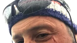 Atac fără avertisment. Bărbat lovit în Deltă, în faţa unui grup de turişti din Germania. Victima a suferit mai multe răni la nivelul feţei - VIDEO 