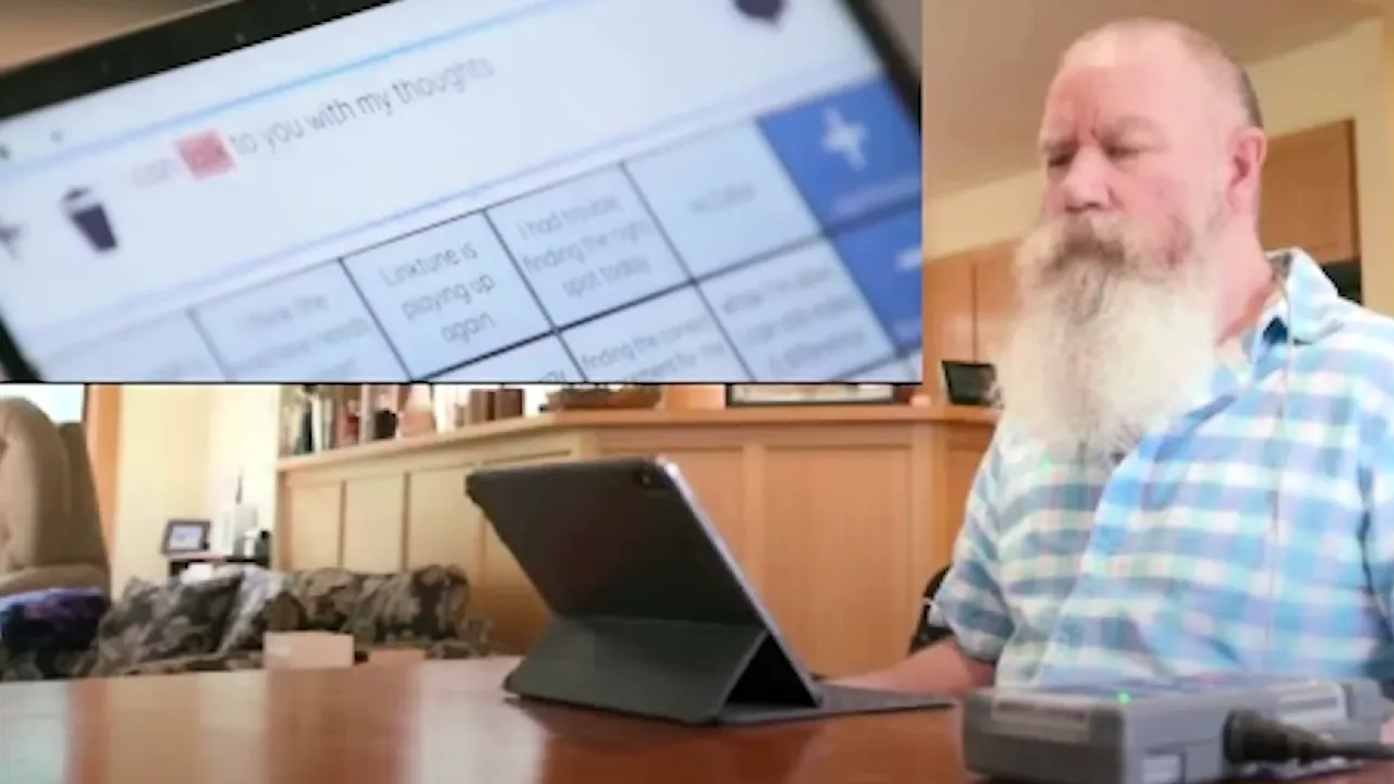 Synchron a creat o metodă nouă pentru a conecta creierul la un calculator, fără operaţii / Dispozitivul 