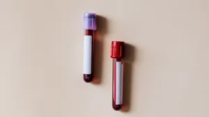 Un test de sânge detectează 50 de tipuri de cancer înainte să apară simptomele