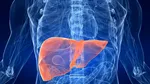Terapia care ar putea ajuta la prevenirea cancerului hepatic provocat de alimente