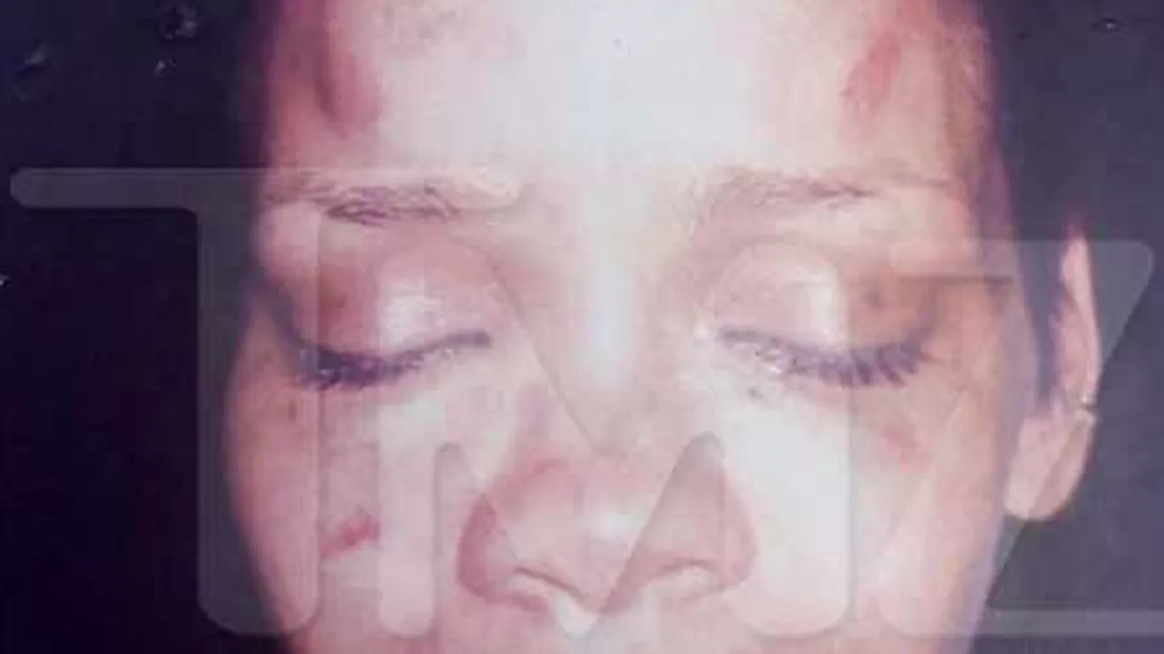 Rihanna desfigurată (Video)