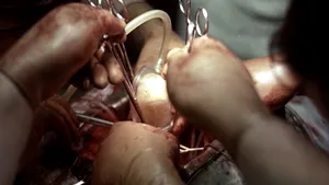 Premieră medicală în SUA. Doctorii au transplantat o inimă readusă la viaţă după ce a încetat să bată