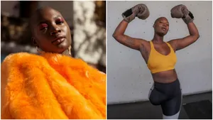 A murit Mama Cax, un simbol pentru persoanele cu dizabilităţi din industria modei. Fotomodelul avea doar 30 de ani