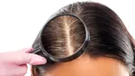 Ce definește un șampon antimătreață bun pentru păr și scalp? (P)