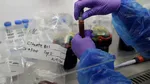 Un nou test de sânge poate detecta din timp 12 tipuri de cancer