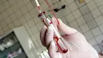 Cercetătorii francezi identifică un nou tip de sânge – Gwada negativ – aparținând unei femei din Franța