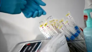 Câte teste pentru noul coronavirus are România 