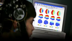 Dispută uriaşă în lumea psihologilor. Unii specialişti susţin că terapia cu electroşocuri poate crea leziuni cerebrale