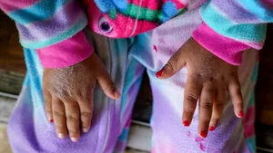 ALERTĂ privind un sindrom grav observat la copii. Specialiştii nu ştiu dacă are legătură cu COVID-19