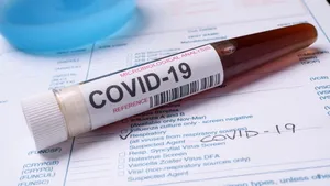 Aparat care poate face 450 de teste în fiecare zi, donat Spitalului de Boli Infecţioase din Iaşi