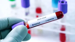 Medicii români au testat pentru coronavirus 473 de persoane. Doar 3 pacienţi au avut rezultat pozitiv