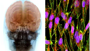 Tratamentul care ar putea vindeca o boală ce afectează zeci de mii de români. Descoperirea cercetătorilor
