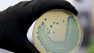 MAE: Alertă alimentară în Spania. 161 de cazuri şi un deces în urma infectării cu bacteria Listeria