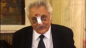 Deputatul Bacalbaşa, după ce a apărut accidentat destul de grav în Parlament: Nasul, chit că s-a rupt, m-a protejat