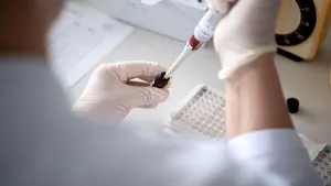 Medic italian: cazurile de coronavirus sunt în scădere şi virusul ar putea dispărea de la sine